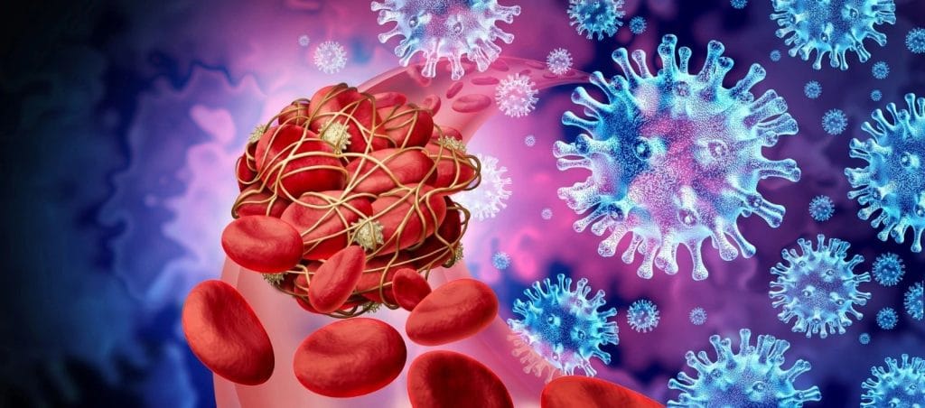 Plaquettes sanguines enveloppées par la protéine du fibrinogène et le virus de l'épi COVID-19